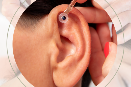 pessoa recebendo tratamento de auriculoterapia